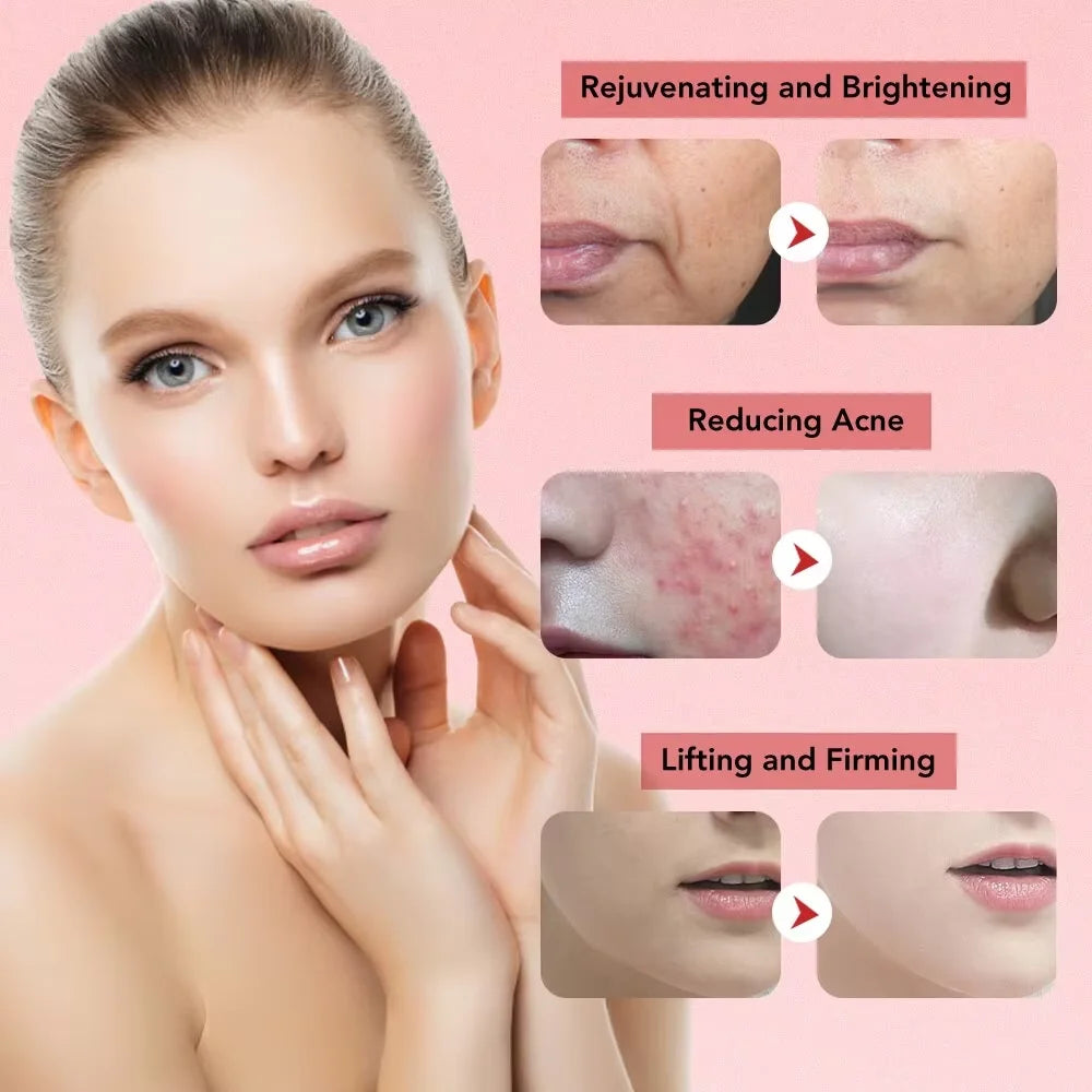 Skin Rejuvenation Device 7-in-1 | EMS & RF | LED Lifting Therapy