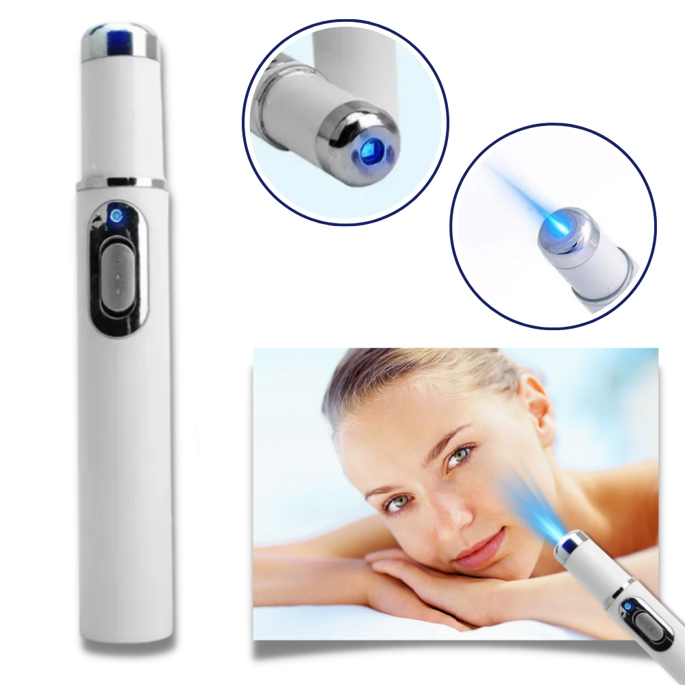 Laser Skincare Pen for Blemish Removal