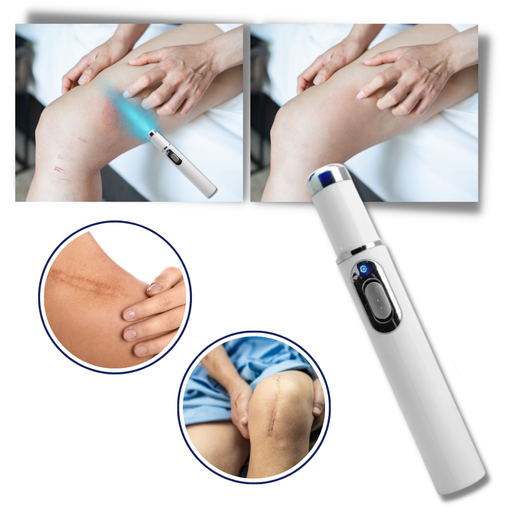Laser Skincare Pen for Blemish Removal