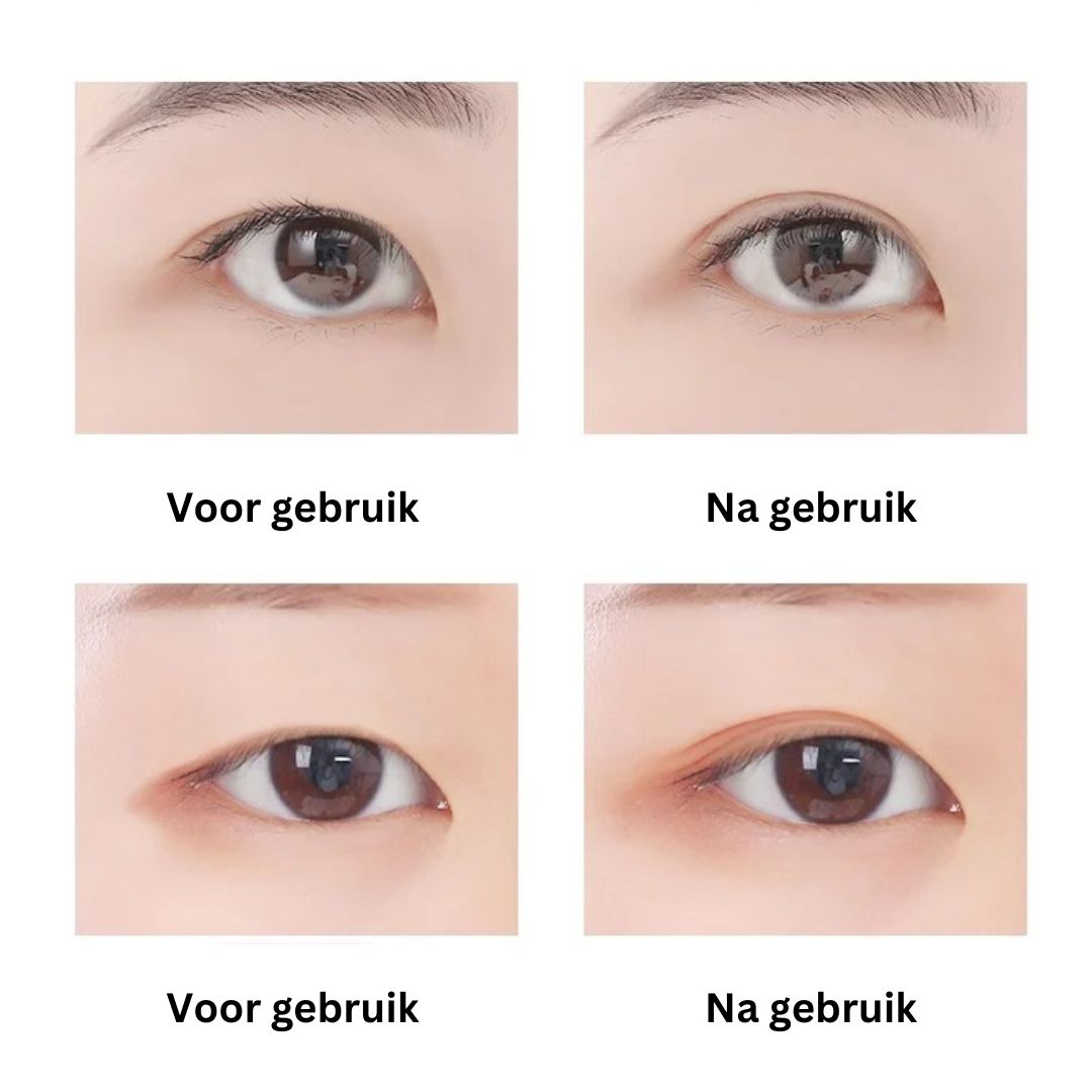 LiftMeUp | Invisible Eyelid Strips for Instant Freshness | Unisex