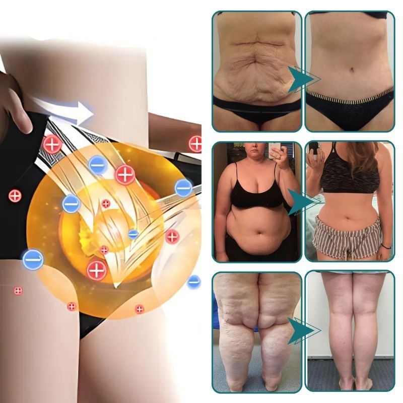 SlimFit Shorts | Schneller Fettabbau und straffere Haut