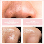 Radiant Skin Device – Quick Cleanse for a Fresh Look