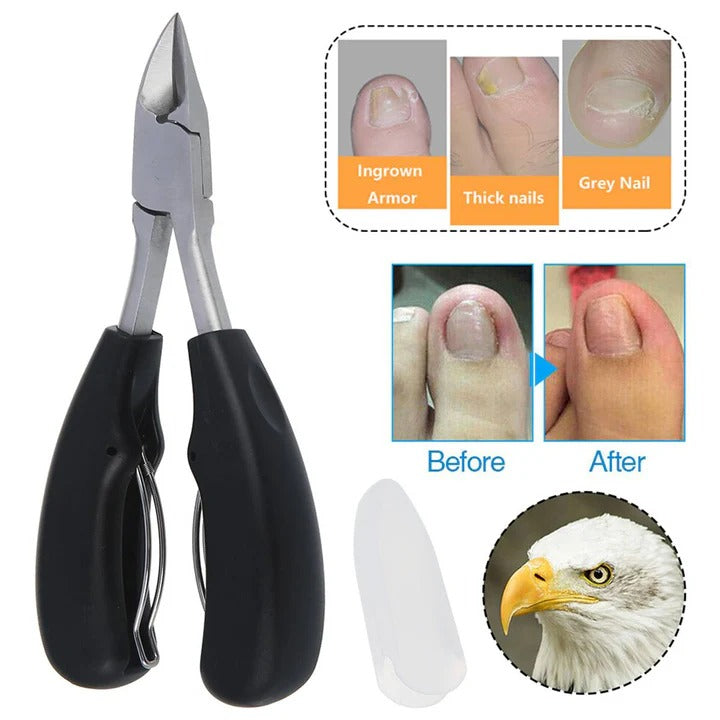 Breite Nagelknipser für Dicke Nägel mit Integrierter Feile