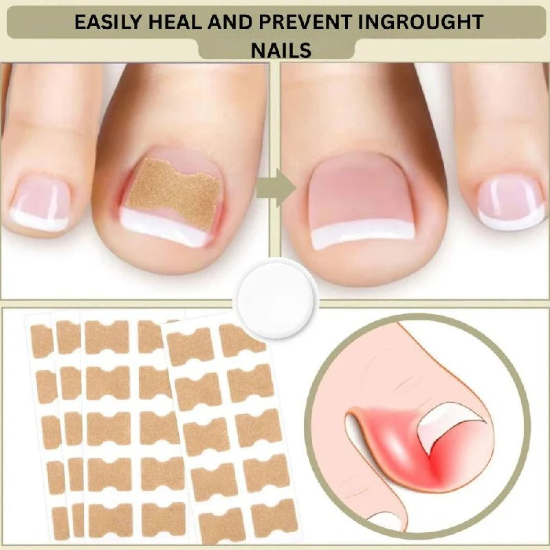 Klebende Nagelstützen für geschwungene Nägel und tägliche Pflege