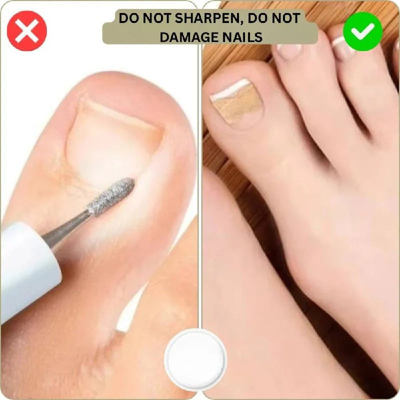 Klebende Nagelstützstreifen für geschwungene Nägel und tägliche Pflege