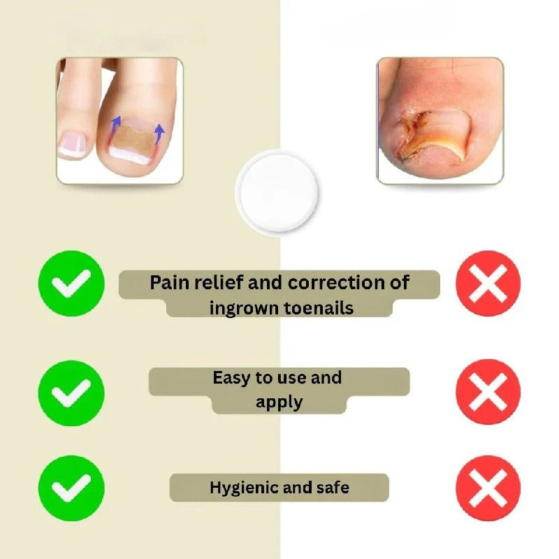 Klebende Nagelstützstreifen für geschwungene Nägel und tägliche Pflege