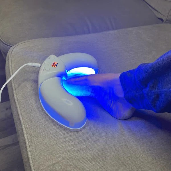 Nagelpilz-Lasergerät zur Behandlung