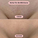 Sanfter Intimrasierer für Damen – Rasieren ohne Irritationen