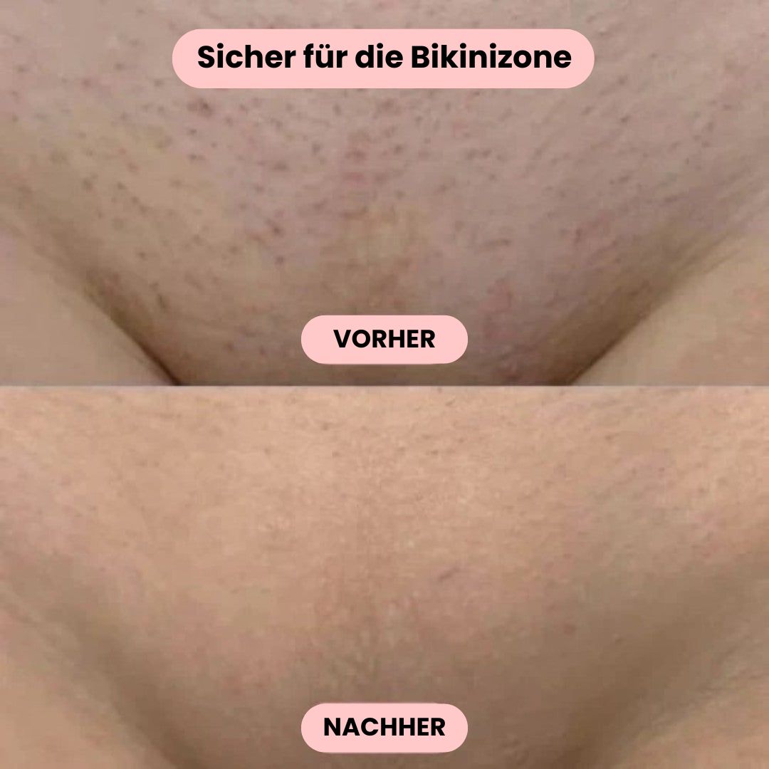 Sanfter Intimrasierer für Damen – Rasieren ohne Irritationen