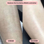 Sanfter Intimrasierer für Damen – Rasieren ohne Irritationen