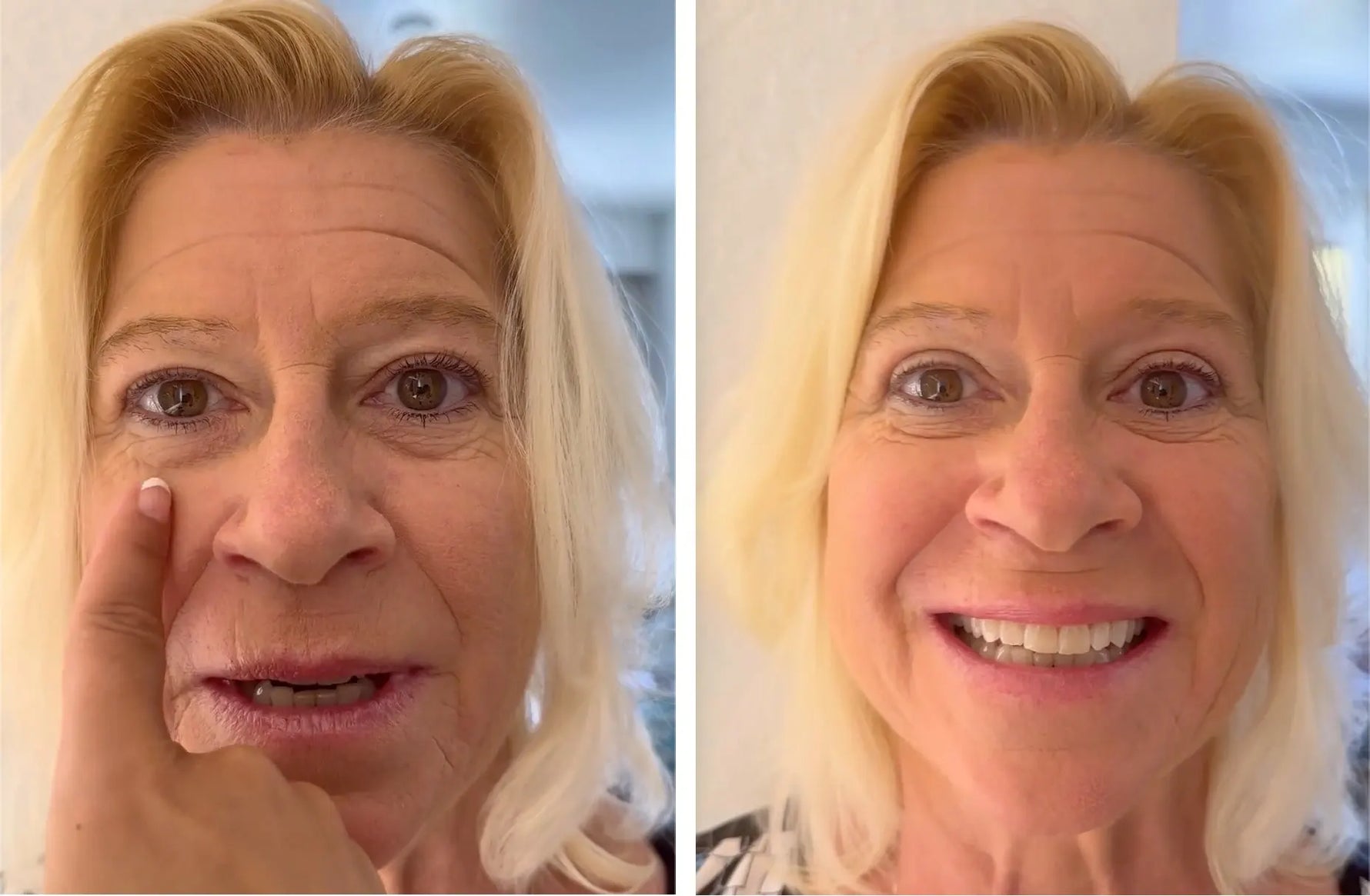 LiftMeUp | Invisible Eyelid Strips for Instant Freshness | Unisex