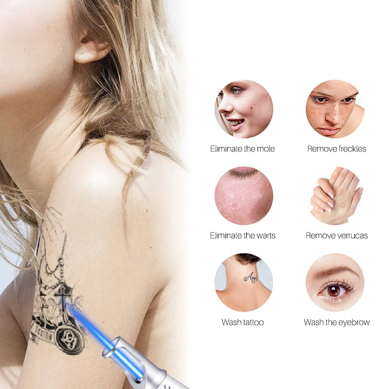 Tattoo Removal Laser Device for Acne, Freckles, and Birthmarks