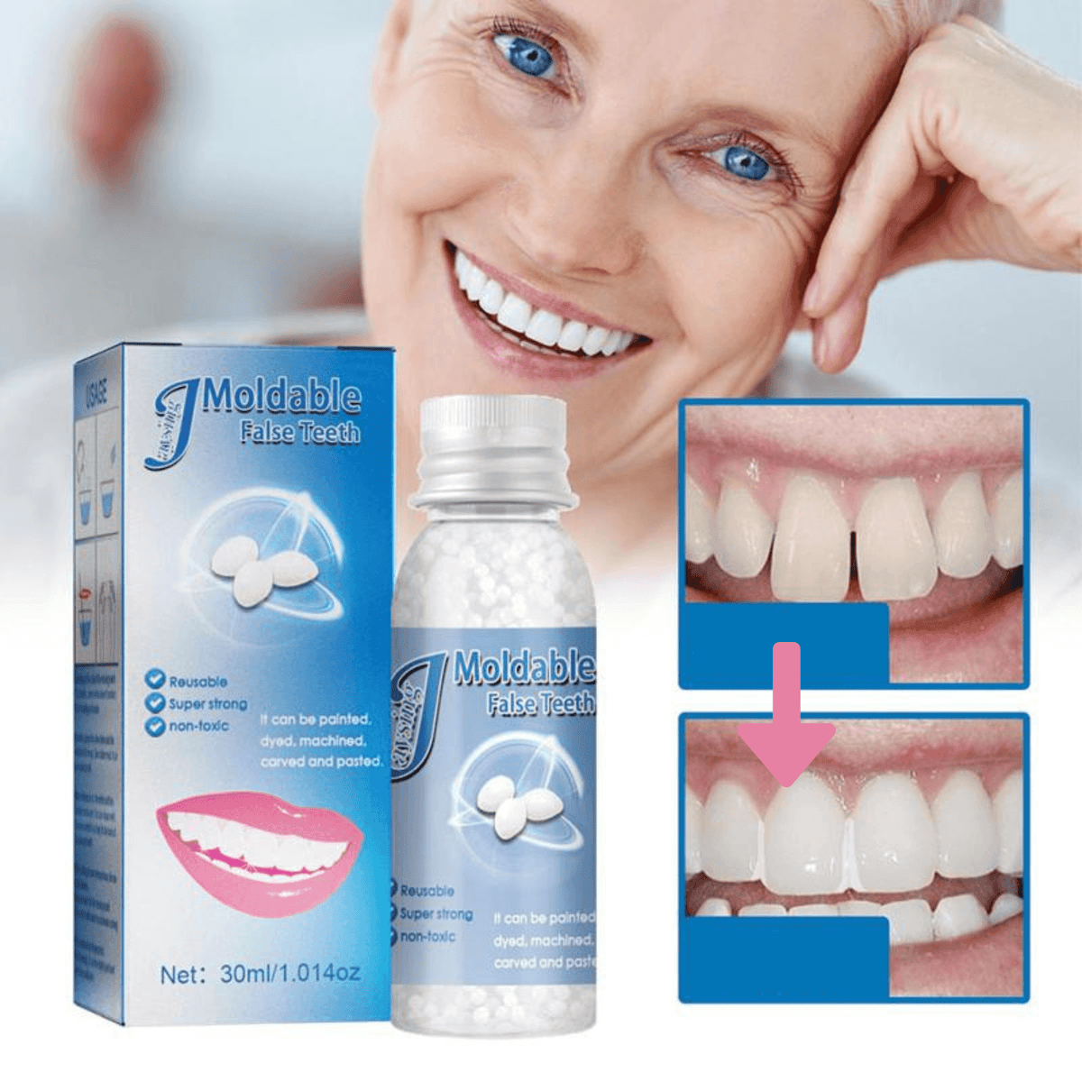 Instant Smile Repair Beads for Unisex Temporary Dental Fix