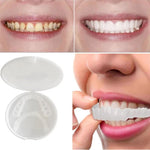 Instant Cosmetic Tooth Veneers for a Confident Smile - Unisex