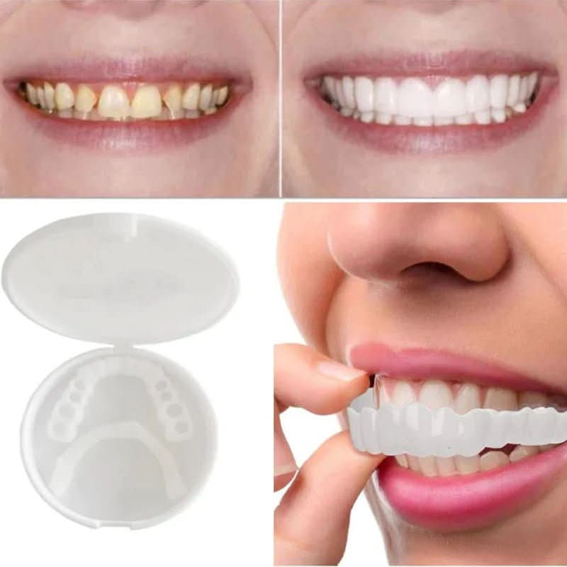 Instant Cosmetic Tooth Veneers for a Confident Smile - Unisex